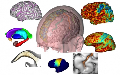 Detraumatisasi, Neurosains, dan Hipnoterapi Klinis